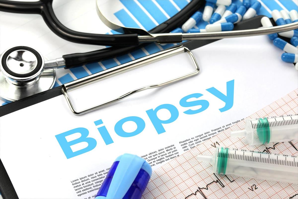 Biopsy